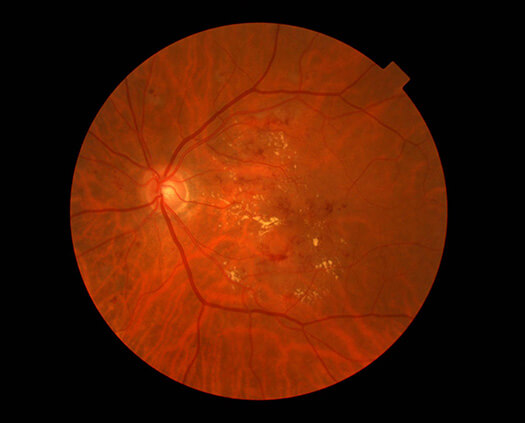 AllegrettoWave 400 Eye-Q