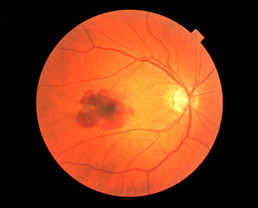 AllegrettoWave 400 Eye-Q