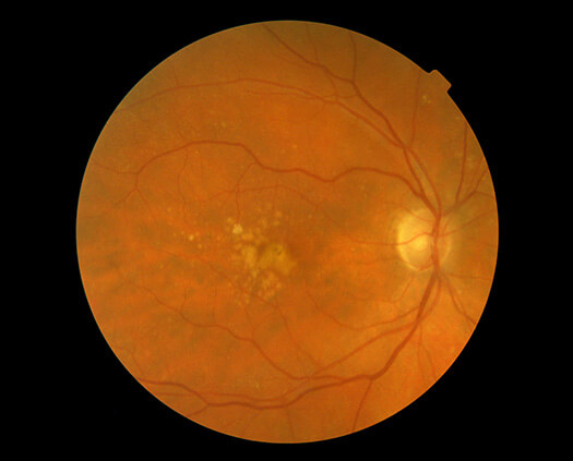 AllegrettoWave 400 Eye-Q