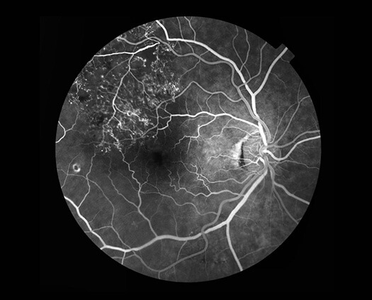 AllegrettoWave 400 Eye-Q
