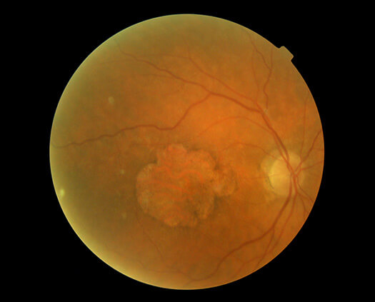 AllegrettoWave 400 Eye-Q