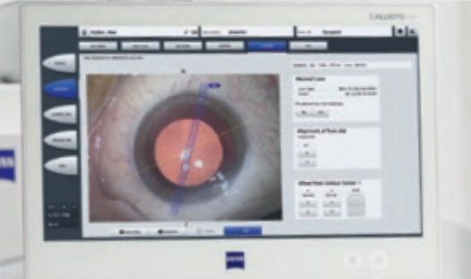 AllegrettoWave 400 Eye-Q